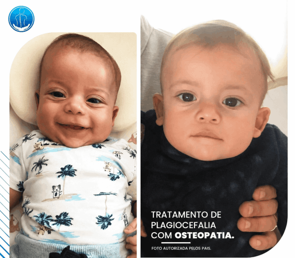 Atendimento de osteopatia pediátrica